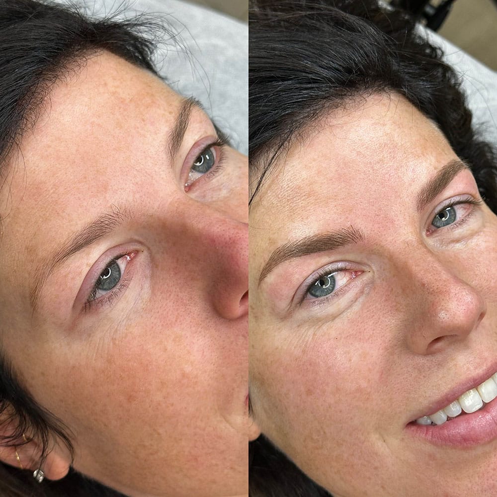 A woman's face is split, showing her left eyebrow before microblading and her right eyebrow after.